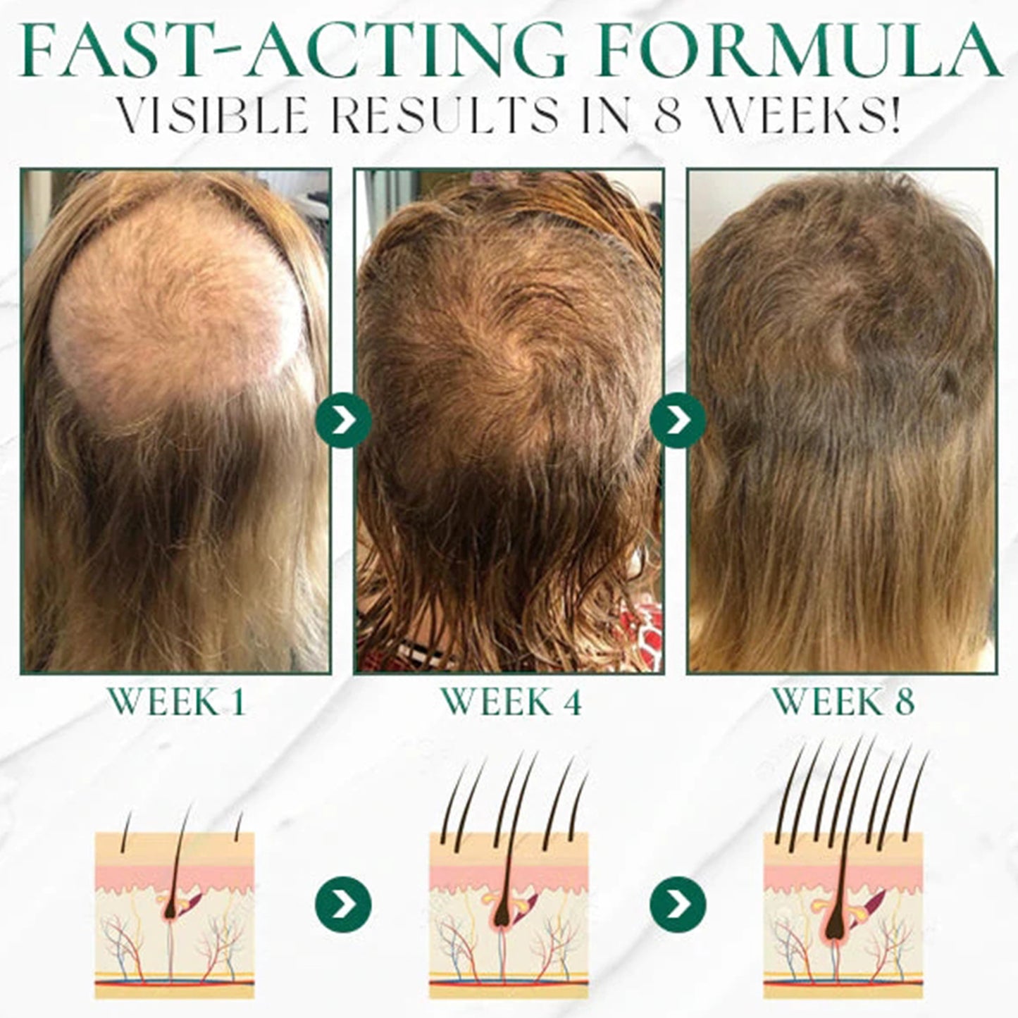 Centella Asiática Exfoliante Limpieza Capilar | Caspa Alivio de comezón - nexbuy.com.mx