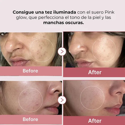 Medicube - PDRN Suero Péptido Rosa