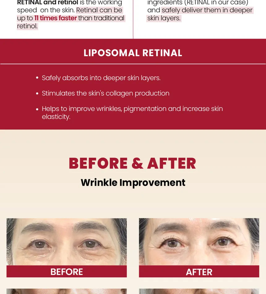 KSECRET - SEOUL 1988 Crema : Retinal Liposome 1%+Arroz Fermentado